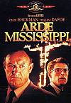 Arde Mississippi