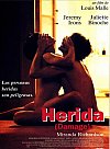 Herida