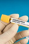 Coronavirus, cómo comenzó todo (TV)